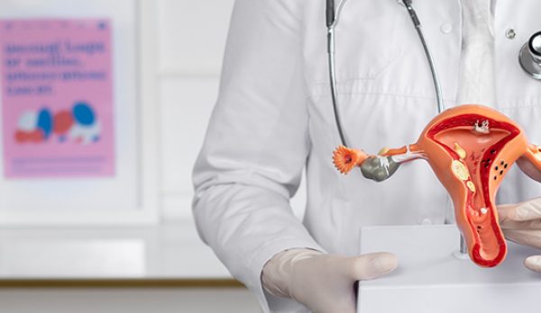 FIBROID FIBROID